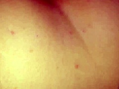 Anal rasping: a potentially tearful procedure