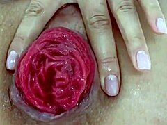 Destroyed Anal Prolapse in Extreme Close-Up Play