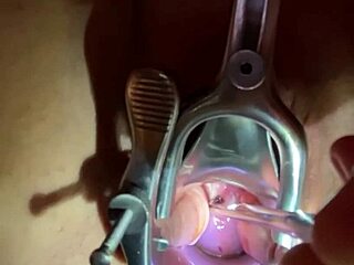 Sound Tenaculum Inserted Deep Into Cervix for Extreme Fetish.