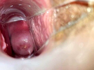 Speculum deep inside pussy for relentless homemade exam